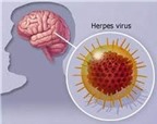 Khuyến cáo về phòng chống bệnh viêm não virus