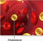 Điều cần biết khi dùng thuốc giảm mỡ máu atorvastatin