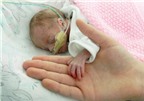 Sức sống kỳ diệu của em bé chào đời chỉ nặng 700 gam
