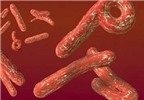Phòng tránh virus Ebola bằng cách nào?