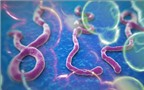 Phòng bệnh sốt xuất huyết Ebola như thế nào?