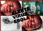 Dấu hiệu nhận biết sớm người nhiễm Ebola trong thời gian ủ bệnh