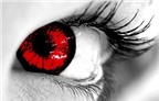 Đau mắt đỏ kiêng ăn gì?