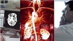 Ung thư phổi có thể được phát hiện bằng máy đo hơi thở