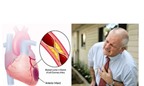 Làm thế nào để nhận biết cơn đau tim và đột quỵ?