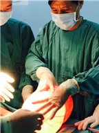 Bóc tách thành công 2 khối u nặng gần 8 kg ở một phụ nữ Mông