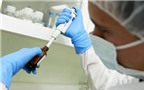 Pháp nghiên cứu que thử Ebola trong 15 phút