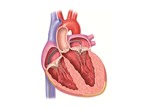 10 điểm mới trong điều trị bệnh van tim