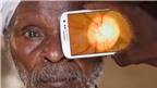 Peek Retina: Hãy để smartphone chăm sóc mắt của bạn