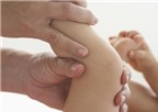 Làm sao để phục hồi chức năng bàn chân khoèo?