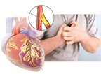 Những nguy cơ trên tim mạch khi bổ sung testosteron