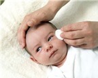 Cẩn trọng bệnh viêm kết mạc ở trẻ sơ sinh