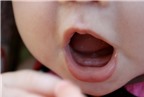 Phân biết trẻ mọc răng hay bị bệnh