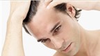 Phương pháp mới và những cách chữa rụng tóc, hói đầu