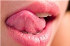 Lưỡi bị rát và nổi mụn là bệnh gì?