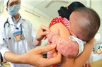 Trẻ bị sốt phát ban phải làm sao?