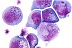 Điểm mặt các loại virus gây ung thư đáng sợ (P1)