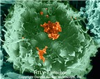 Điểm mặt các loại virus gây ung thư đáng sợ (P2)