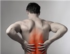 5 thói quen dễ gây đau lưng