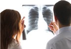 Tìm hiểu nguyên nhân gây ra ung thư phổi