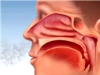 Viêm xoang mũi: Triệu chứng và cách phòng tránh