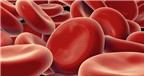 Thalassemia là bệnh gì?