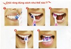 Một số bệnh răng miệng thường gặp