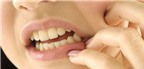 Một số điều ai cũng cần biết để ngăn ngừa sâu răng