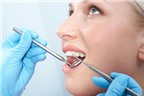 Cách điều trị răng cửa bị sâu tốt nhất