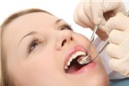 Cách phòng ngừa các bệnh răng miệng