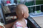 UT15: Xin hãy giúp đỡ cháu bé dân tộc Thái bị ung thư não
