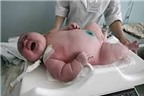 Chuyện lạ có thật: Bà mẹ sinh con nặng 18,2kg ở Úc