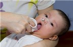 Phòng và điều trị nhiệt miệng ở trẻ