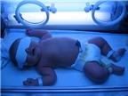Tất tần tật về bệnh vàng da ở trẻ sơ sinh