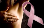 Khi nào nên sàng lọc ung thư vú?