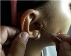 Trẻ dễ thủng nhĩ nếu lấy ráy tai không đúng cách