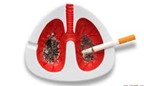 Thuốc mới kỳ diệu điều trị ung thư phổi