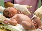 8 lý do không nên cắt dây rốn sớm sau khi trẻ chào đời