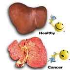 Cách phòng bệnh viêm gan B
