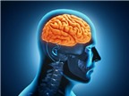 Làm sao để ngăn ngừa chứng phình động mạch não?