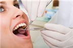 Chi tiết cách tự kiểm tra sức khỏe răng miệng cơ bản