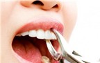 Khi nào nên và không nên đi nhổ răng?