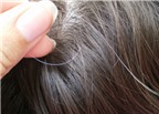 4 giải pháp đẩy lùi hiện tượng tóc bạc sớm