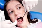 Cách chữa sâu răng hiệu quả nhất