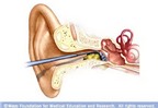 7 cách loại bỏ ráy tai an toàn, không hề đau