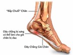 Các bệnh gây đau gót chân và thuốc trị