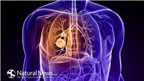 Giảm nguy cơ ung thư phổi bằng cách ăn tỏi sống